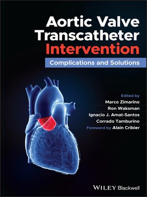 cover image of Aortic Valve Transcatheter Intervention
